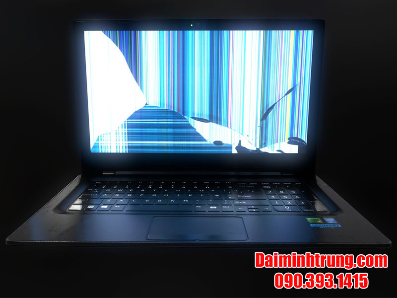 soc man hinh do loi man hinh